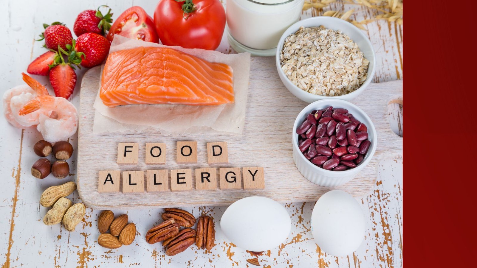 Rotulagem de Alergênicos: a informação que pode salvar vidas - Nutri Jr USP